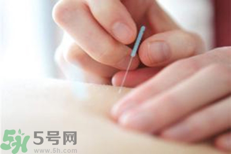 大暑可以針灸嗎？大暑針灸好不好？