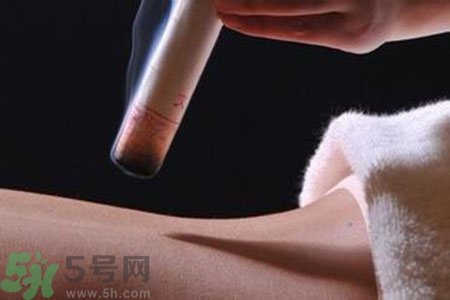 大暑可以艾灸嗎？大暑艾灸的好處有哪些？