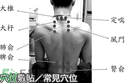 經期可以貼三伏貼嗎？來月經可以貼三伏貼嗎？