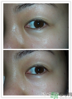 珍視明眼貼怎么用?珍視明眼貼使用方法 珍視明眼貼怎么用?珍視明眼貼使用方法