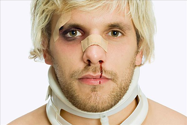 天氣太熱會(huì)流鼻血嗎？天氣太熱流鼻血是什么原因？