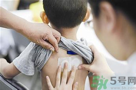 肝炎貼三伏貼有用嗎？肝病貼三伏貼貼哪里？