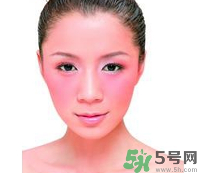 敏感性皮膚用什么洗面奶？敏感性皮膚怎么修復(fù)？