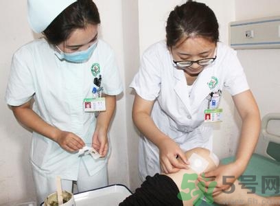 三伏貼可以自己貼嗎？三伏貼貼要找穴位嗎？