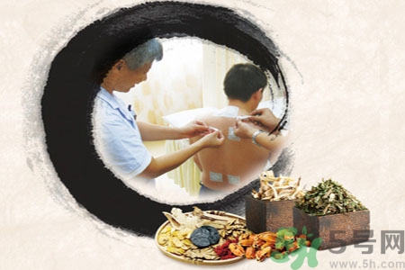 三伏貼可以自己貼嗎？三伏貼貼要找穴位嗎？