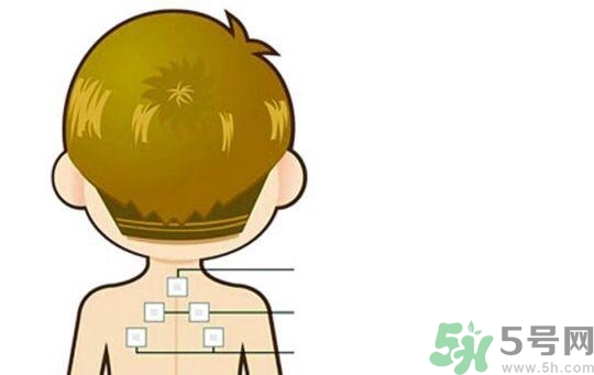 貼三伏貼可以吹空調(diào)嗎？貼完三伏貼多久后可以吹空調(diào)？