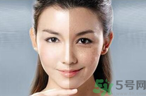 干性皮膚用什么洗面奶？干性皮膚該怎么保養(yǎng)？