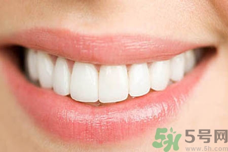 洗牙的好處有哪些？洗牙的好處是什么？