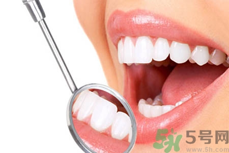 哪些人不能洗牙？洗牙需要注意什么？