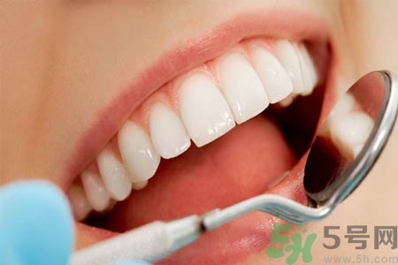 冷光美白牙齒的價格是多少？做冷光美白牙齒需要多少錢？