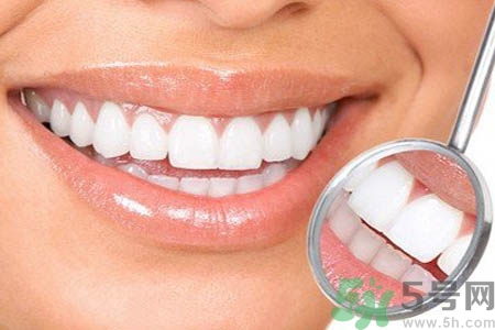 冷光美白牙齒的價(jià)格是多少？做冷光美白牙齒需要多少錢(qián)？