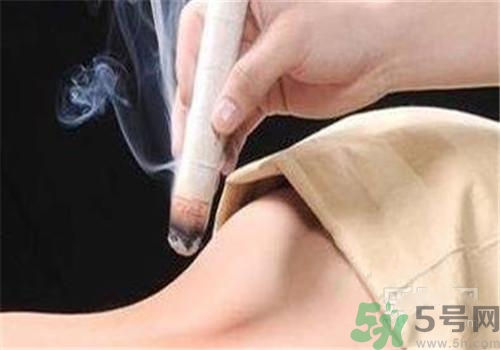 蕁麻疹可以艾灸嗎？蕁麻疹艾灸哪個(gè)穴位？