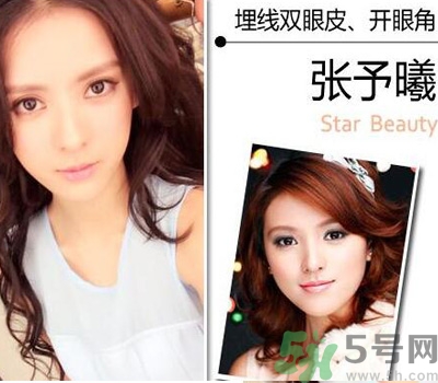 開眼角眼睛會變大嗎？開眼角眼睛能大多少？