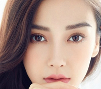 開眼角會留疤嗎？開眼角增生怎么辦？