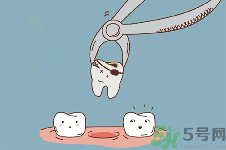 拔牙后需要注意什么？拔牙前需要注意什么？