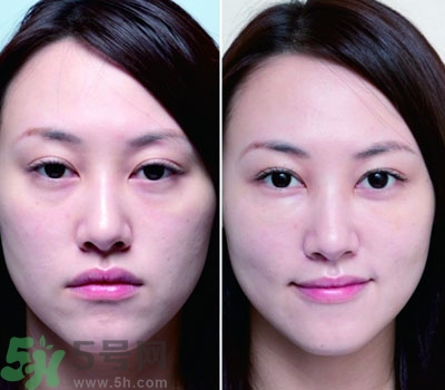 臥蠶是什么？臥蠶是眼袋嗎？