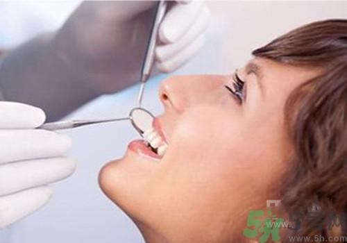 洗牙后多久可以刷牙？洗牙后怎么刷牙？