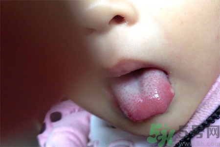 舌頭長泡怎么辦？舌頭長泡的原因？
