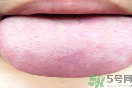 舌頭發(fā)白是什么原因？舌苔發(fā)白是怎么辦？