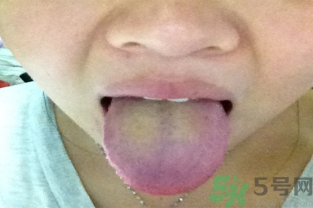 舌苔厚黃是怎么回事？舌頭發(fā)黃怎么辦？