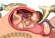 剖腹產(chǎn)橫剖好還是豎剖好？剖腹產(chǎn)橫剖和豎剖有什么區(qū)別？