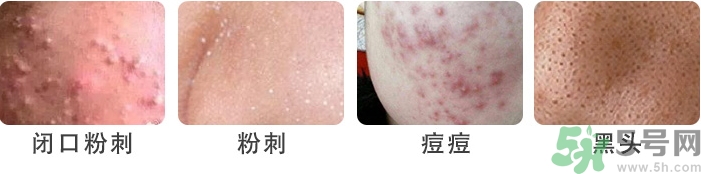 eau precieuse法國珍貴水適合人群 eau precieuse法國珍貴水適合人群