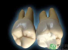 牙齒根管治療多少錢？根管治療一顆要多少錢？