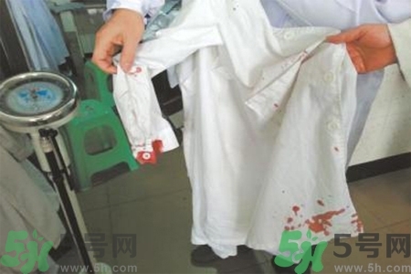 清除衣服上血跡的方法有什么？