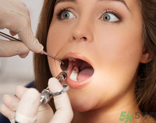 根管治療有什么危害？根管治療的適應(yīng)癥有哪些？