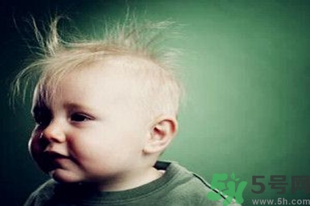 寶寶頭發(fā)少怎么辦？寶寶頭發(fā)少什么原因？