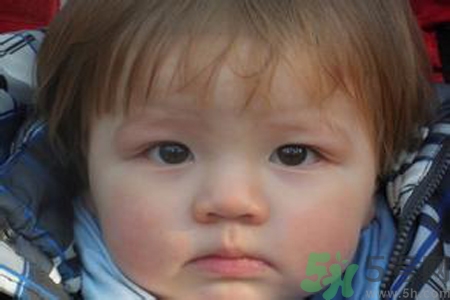 寶寶頭發(fā)黃怎么辦？寶寶頭發(fā)黃什么原因？