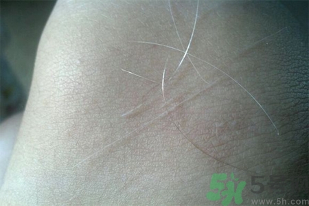 生完寶寶白頭發(fā)的原因？生完寶寶白頭發(fā)怎么辦？