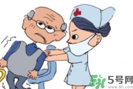 癲癇的典型癥狀有哪些？癲癇是什么？