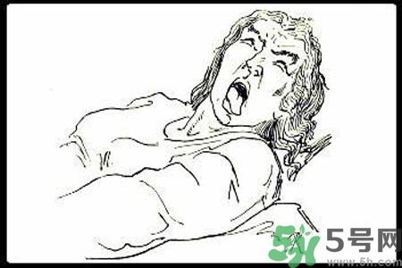 癲癇的護(hù)理措施？癲癇的飲食護(hù)理是什么？