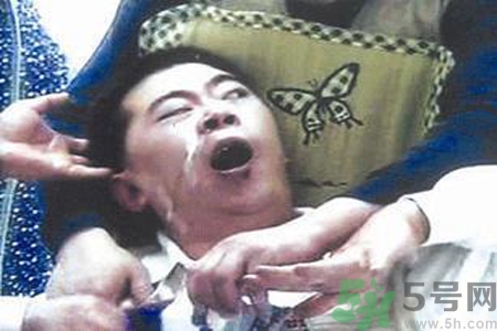 癲癇的發(fā)病因素？癲癇的并發(fā)癥有哪些？