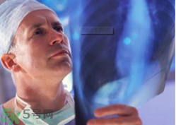 胸透主要檢查什么？男性和女性分別胸透后多久可以要孩子？