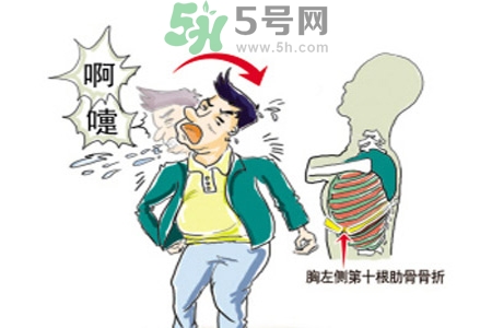 過敏性鼻炎是什么？過敏性鼻炎的癥狀有哪些？