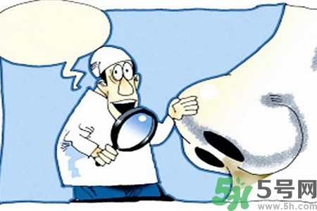 過敏性鼻炎的護理措施是什么？過敏性的飲食護理有哪些？