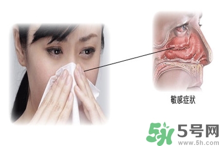 過敏性鼻炎的高發(fā)人群有哪些？如何預(yù)防過敏性鼻炎？