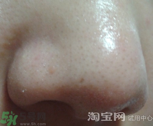 holika豬鼻貼多少錢?holika豬鼻貼韓國價格 holika豬鼻貼多少錢?holika豬鼻貼韓國價格