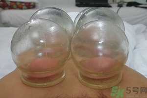 拔火罐的好處和壞處 拔罐的好處和壞處 拔火罐的好處和壞處 拔罐的好處和壞處