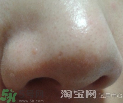 holika豬鼻貼多少錢?holika豬鼻貼韓國價格 holika豬鼻貼多少錢?holika豬鼻貼韓國價格