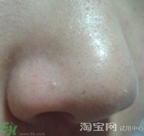 holika豬鼻貼多少錢?holika豬鼻貼韓國價格 holika豬鼻貼多少錢?holika豬鼻貼韓國價格