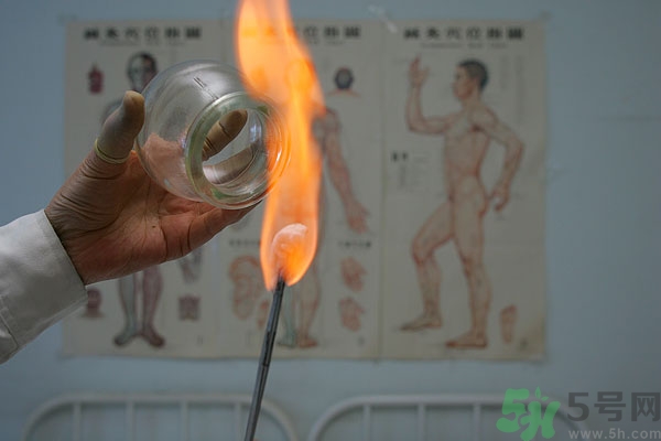 拔火罐的好處和壞處 拔罐的好處和壞處 拔火罐的好處和壞處 拔罐的好處和壞處