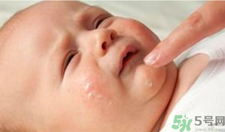 寶寶長奶蘚怎么回事？寶寶長奶蘚怎么辦？