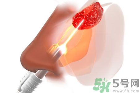 鼻咽癌的日常措施是什么？鼻咽癌注意的飲食有哪些？