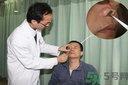 鼻咽癌的治療方法是什么？鼻咽癌可以用什么藥物治療？