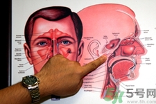 鼻咽癌的發(fā)病因素是什么？鼻咽癌的并發(fā)癥有哪些？