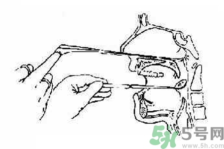 鼻咽癌的高發(fā)人群有哪些？如何預(yù)防鼻咽癌？