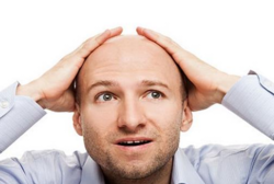 男人禿頂能治好嗎？治療禿頂小偏方